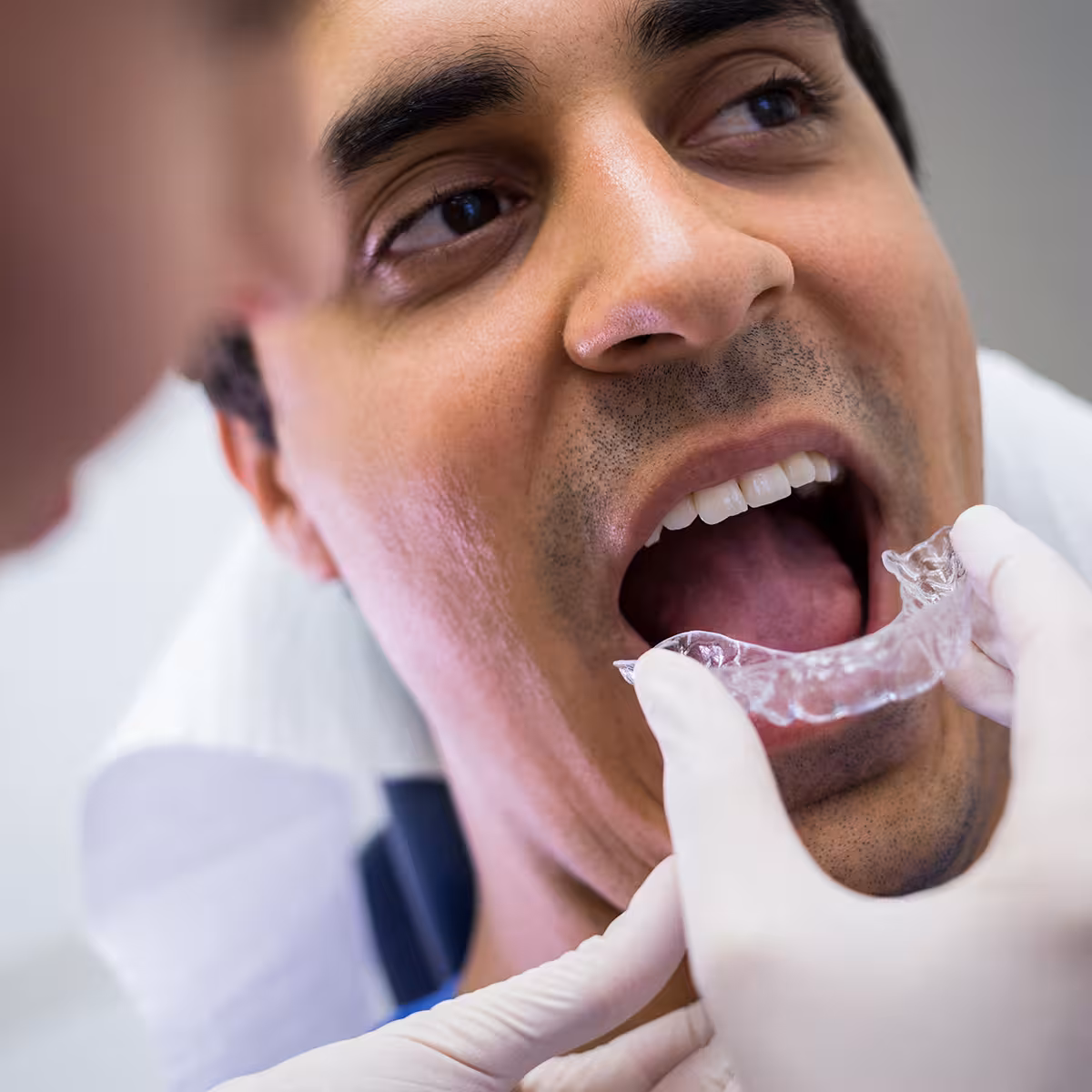 Clear Aligner Türkei: persönliches Invisalign-Style-Angebot