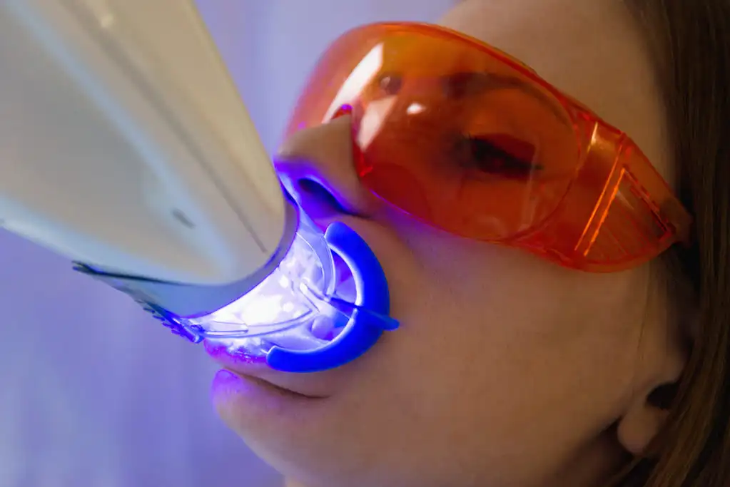 Laser Teeth Whitening Turkey: Is It Worth the Cost?
