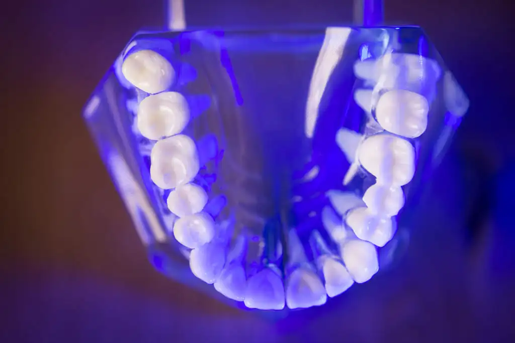 Why Dental Implants Hungary at Helvetic Clinics Are Worth It