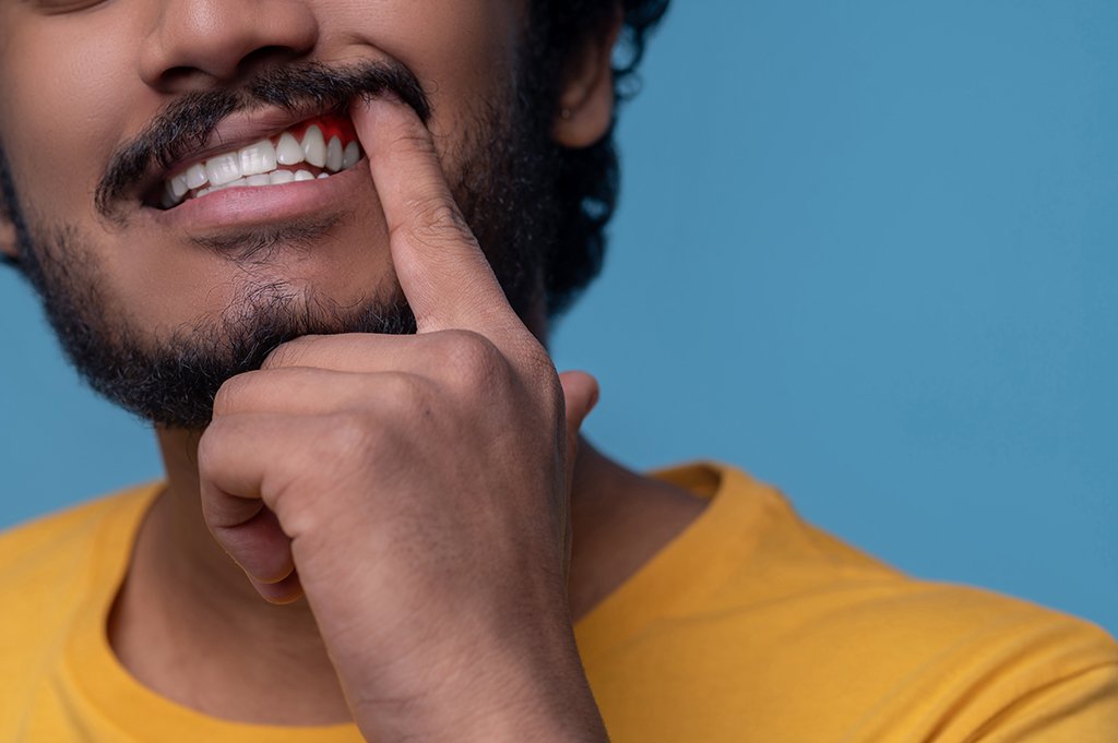 Preventing Diseased Gums: Tips and Tricks