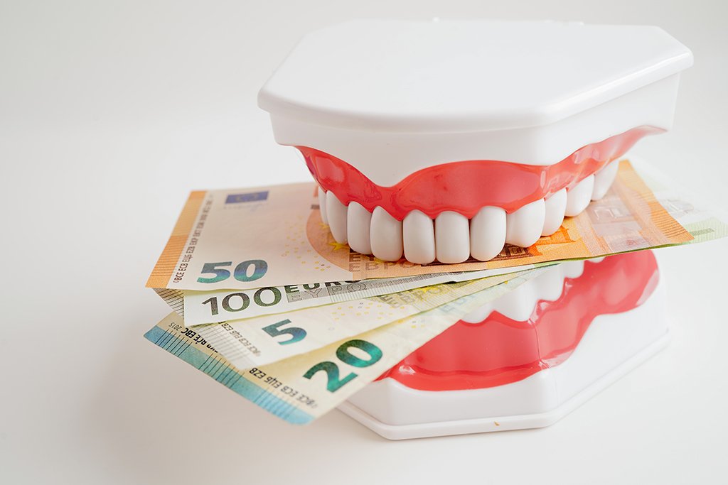 Implant Costs in Turkey – Affordable Dental Excellence for Everyone
