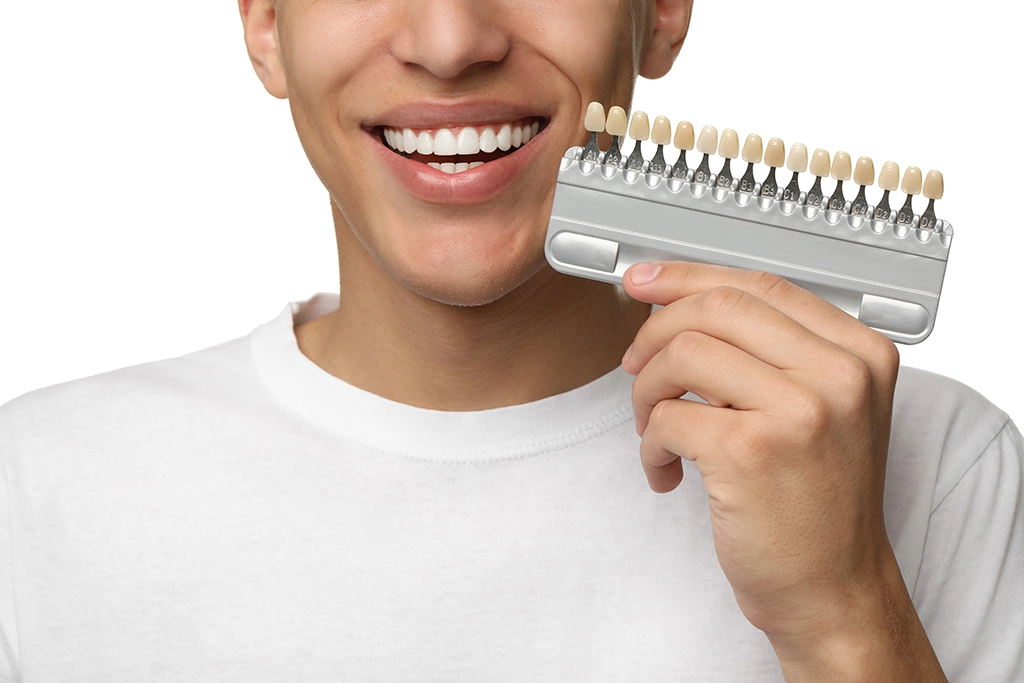 Benefits of E Max Veneers for Smiles