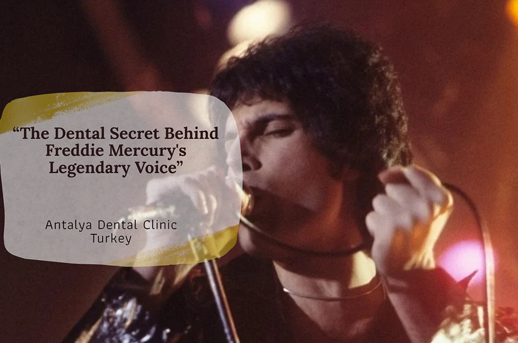 Freddie Mercury Teeth: Why His Smile Captivated the World