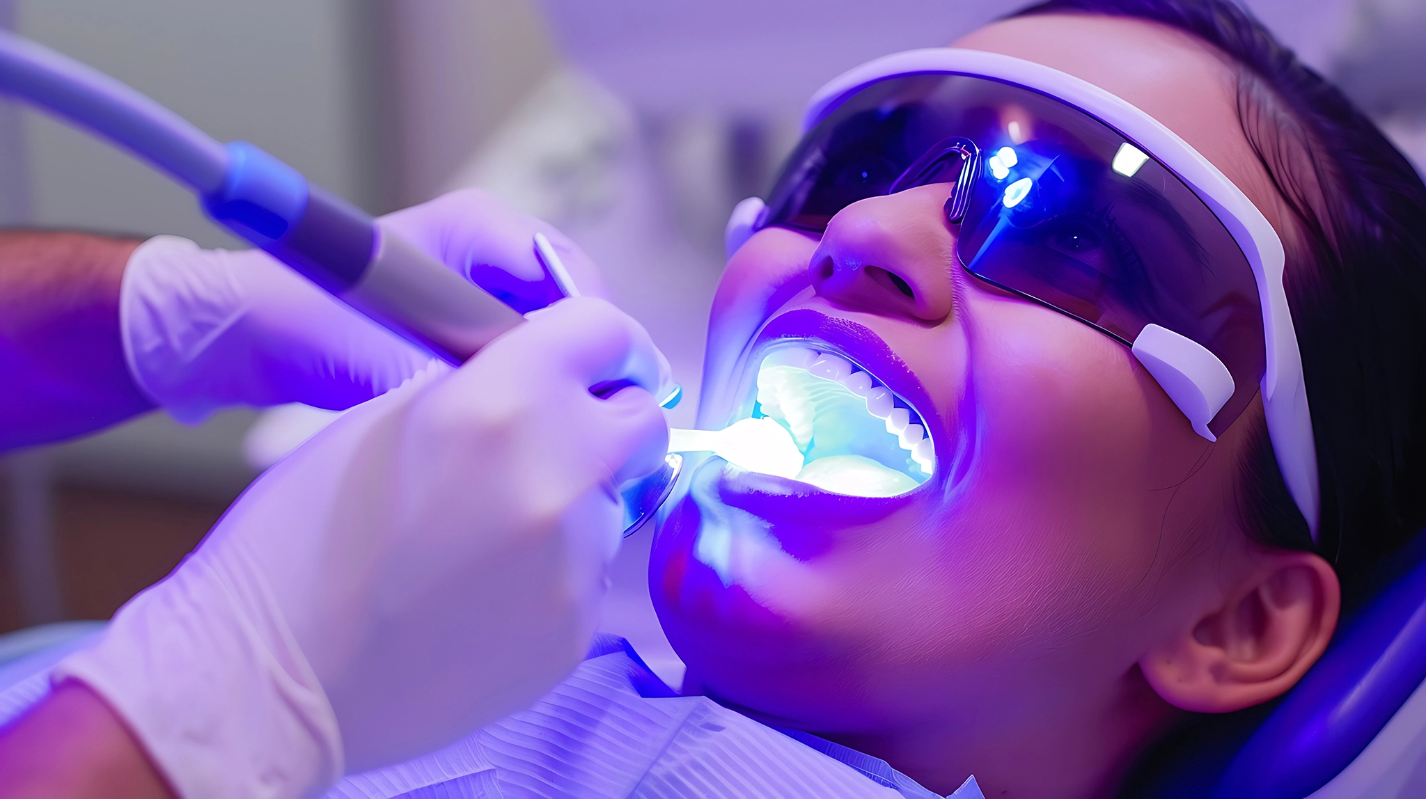 Teeth Whitening