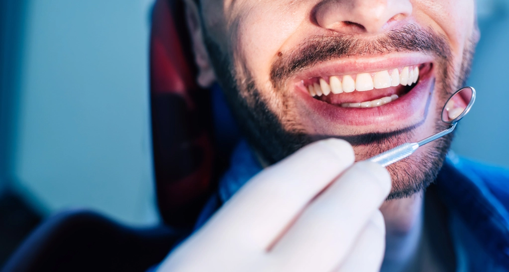 Professional Teeth Cleaning